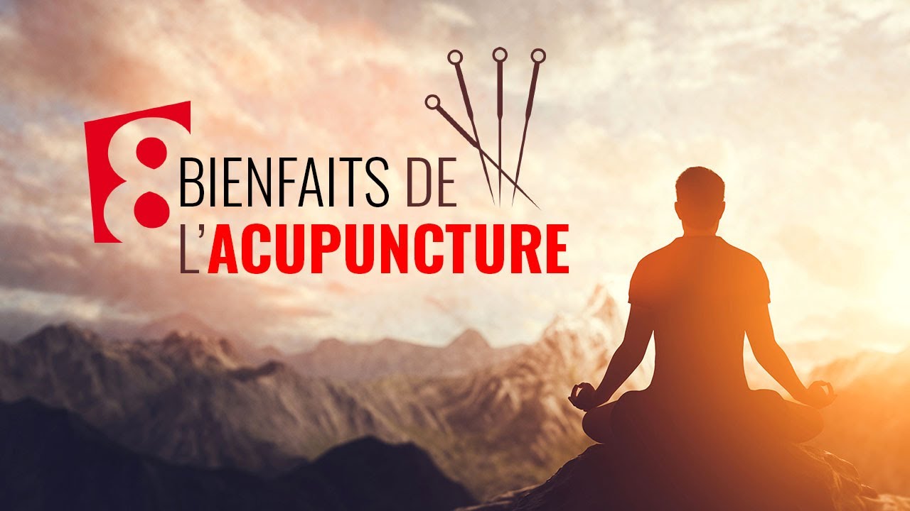 8 bienfaits de l'acupuncture – Index Santé