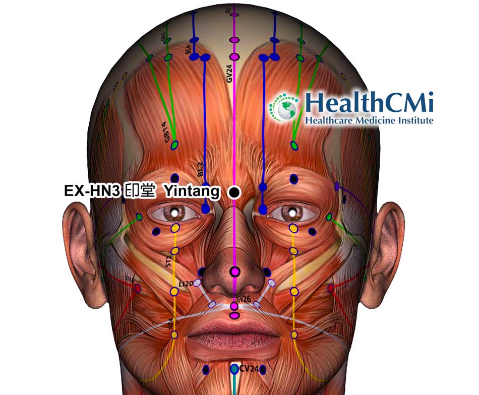 Acupuncture Anxiety Relief in Parkinson’s Disease