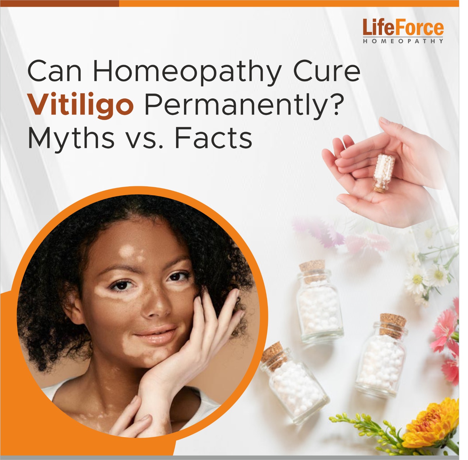 Can Homeopathy Cure Vitiligo Permanently? Myths vs Facts