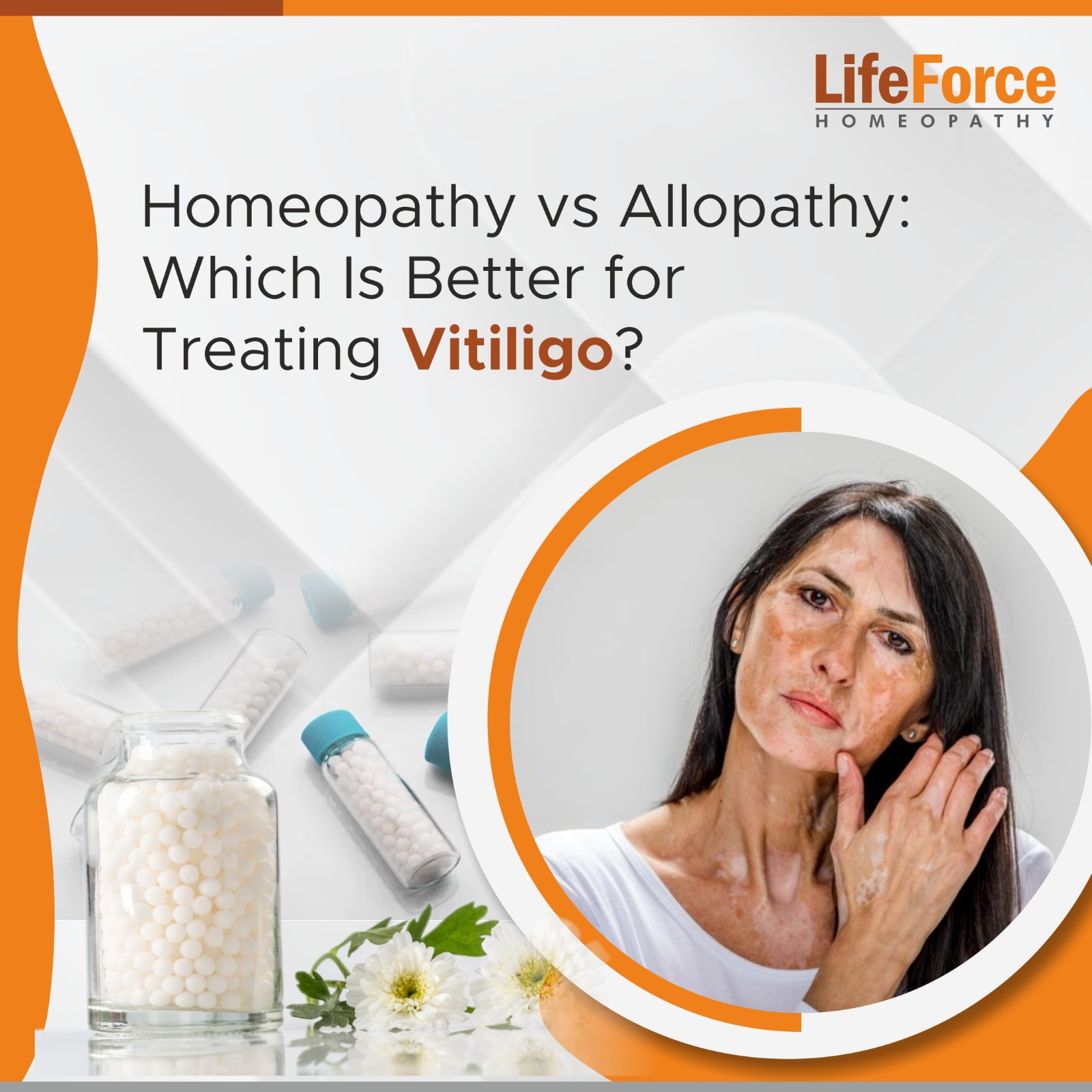 Which Is Better for Treating Vitiligo?